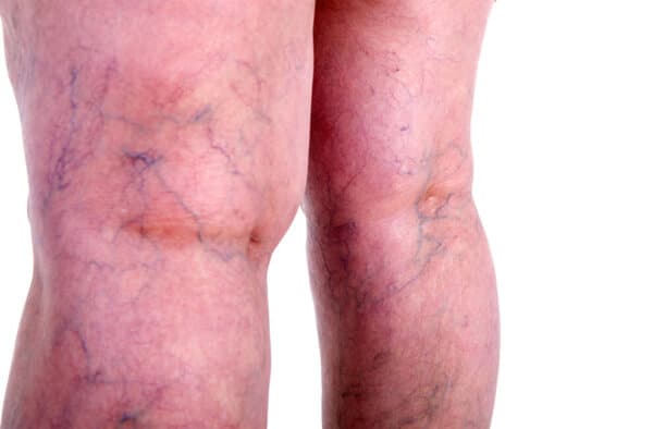 specialist vein health